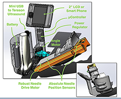 当日研发100名获奖者:GUIDE(超声引导介入仪)